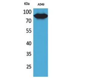 Western blot - CD10 Polyclonal Antibody from Signalway Antibody (41741) - Antibodies.com