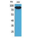Western blot - CD10 Polyclonal Antibody from Signalway Antibody (41741) - Antibodies.com