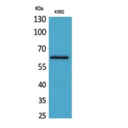 Western blot - HPA1 Polyclonal Antibody from Signalway Antibody (41744) - Antibodies.com