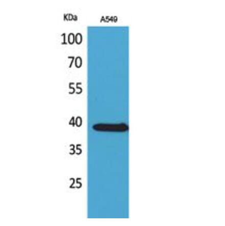 Western blot - NTCP Polyclonal Antibody from Signalway Antibody (41759) - Antibodies.com