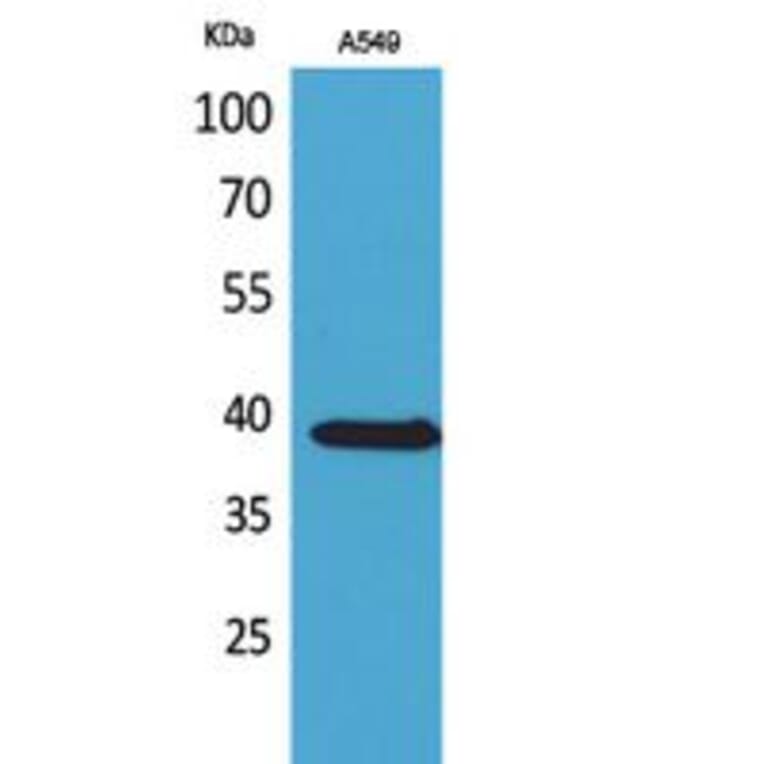 Western blot - NTCP Polyclonal Antibody from Signalway Antibody (41759) - Antibodies.com