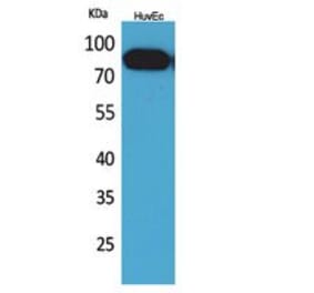 Western blot - CD71 Polyclonal Antibody from Signalway Antibody (41761) - Antibodies.com