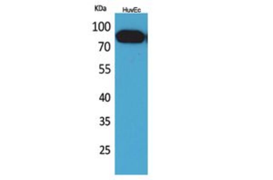 Western blot - CD71 Polyclonal Antibody from Signalway Antibody (41761) - Antibodies.com