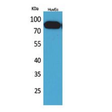 Western blot - CD71 Polyclonal Antibody from Signalway Antibody (41761) - Antibodies.com