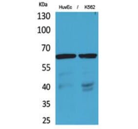 Western blot - OAT1 Polyclonal Antibody from Signalway Antibody (41770) - Antibodies.com