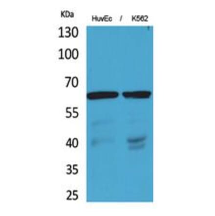 Western blot - OAT1 Polyclonal Antibody from Signalway Antibody (41770) - Antibodies.com
