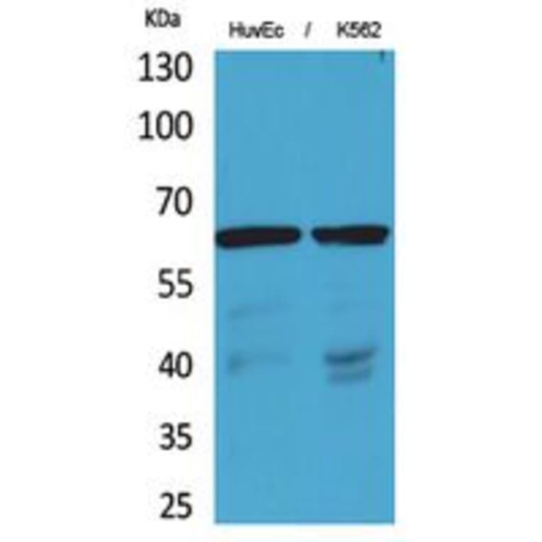 Western blot - OAT1 Polyclonal Antibody from Signalway Antibody (41770) - Antibodies.com