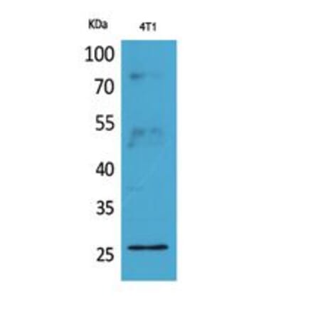 Western blot - CD81 Polyclonal Antibody from Signalway Antibody (41779) - Antibodies.com