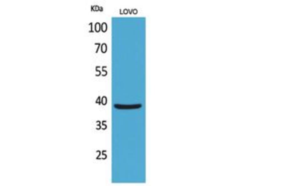 Western blot - EKLF Polyclonal Antibody from Signalway Antibody (41805) - Antibodies.com