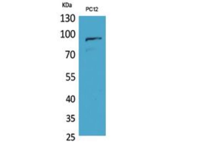Western blot - PCAF Polyclonal Antibody from Signalway Antibody (41809) - Antibodies.com