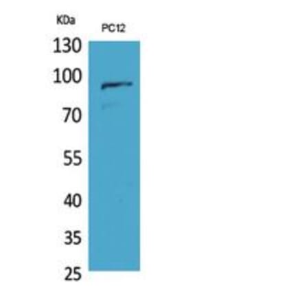 Western blot - PCAF Polyclonal Antibody from Signalway Antibody (41809) - Antibodies.com