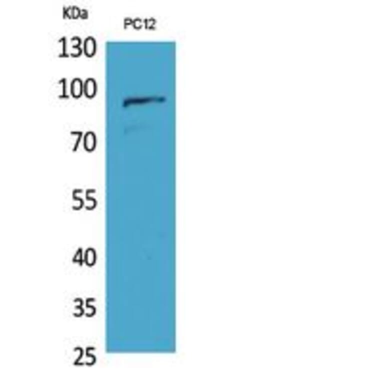 Western blot - PCAF Polyclonal Antibody from Signalway Antibody (41809) - Antibodies.com