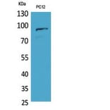 Western blot - PCAF Polyclonal Antibody from Signalway Antibody (41809) - Antibodies.com