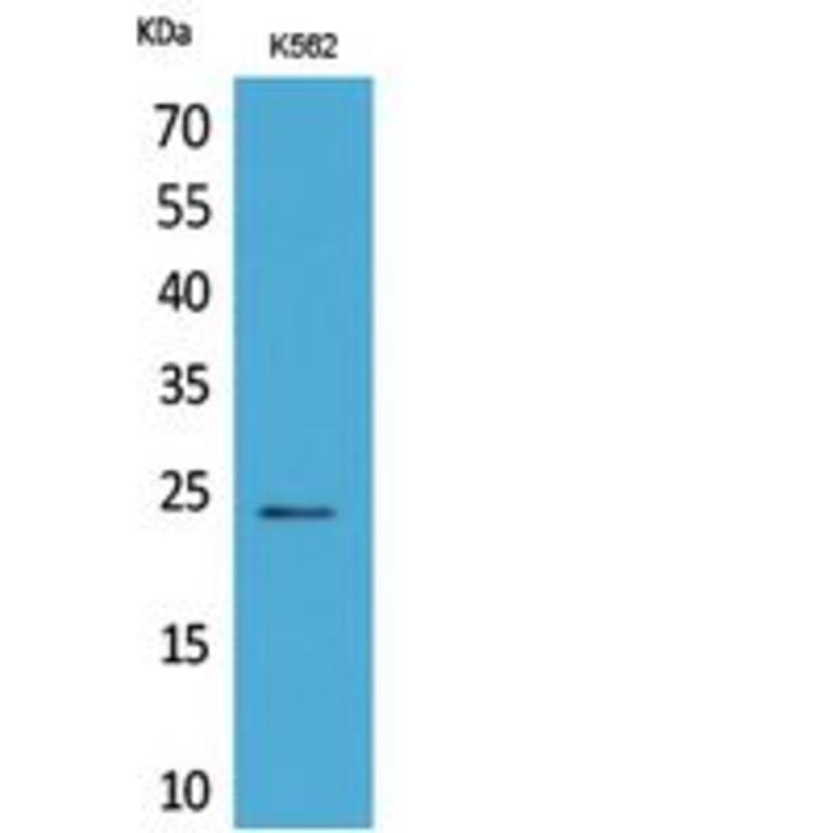 Western blot - CyPB Polyclonal Antibody from Signalway Antibody (41814) - Antibodies.com