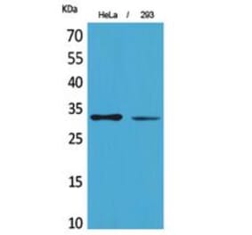 Western blot - SDHB Polyclonal Antibody from Signalway Antibody (41824) - Antibodies.com