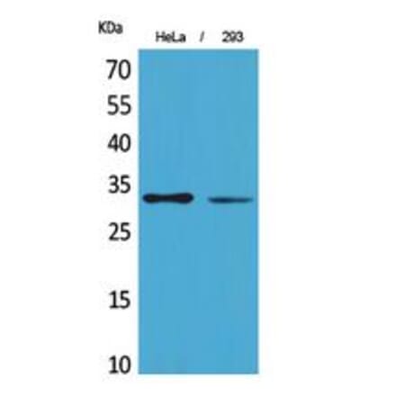 Western blot - SDHB Polyclonal Antibody from Signalway Antibody (41824) - Antibodies.com