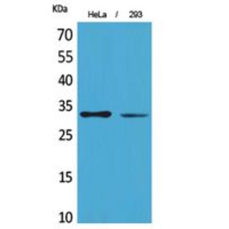 Western blot - SDHB Polyclonal Antibody from Signalway Antibody (41824) - Antibodies.com