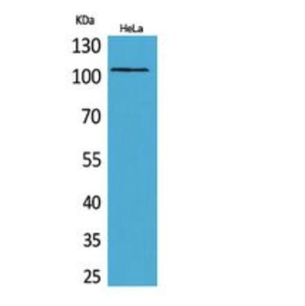 Western blot - MCM6 Polyclonal Antibody from Signalway Antibody (41827) - Antibodies.com