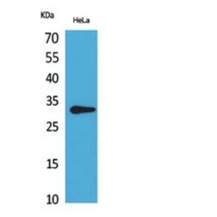 Western blot - CD37 Polyclonal Antibody from Signalway Antibody (41834) - Antibodies.com