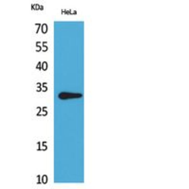 Western blot - CD37 Polyclonal Antibody from Signalway Antibody (41834) - Antibodies.com