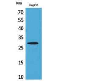 Western blot - CD69 Polyclonal Antibody from Signalway Antibody (41835) - Antibodies.com