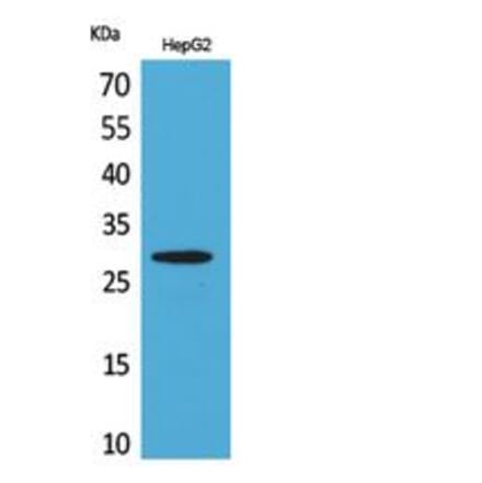 Western blot - CD69 Polyclonal Antibody from Signalway Antibody (41835) - Antibodies.com