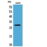 Western blot - CD69 Polyclonal Antibody from Signalway Antibody (41835) - Antibodies.com