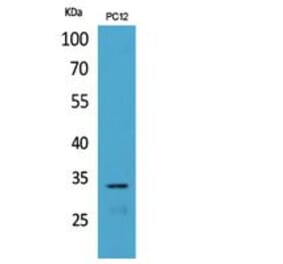 Western blot - CD74 Polyclonal Antibody from Signalway Antibody (41836) - Antibodies.com
