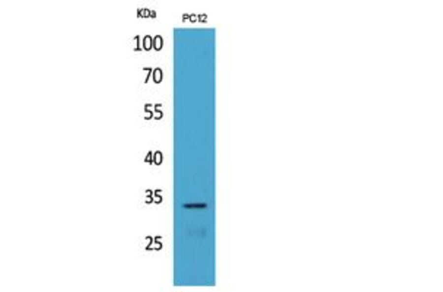 Western blot - CD74 Polyclonal Antibody from Signalway Antibody (41836) - Antibodies.com