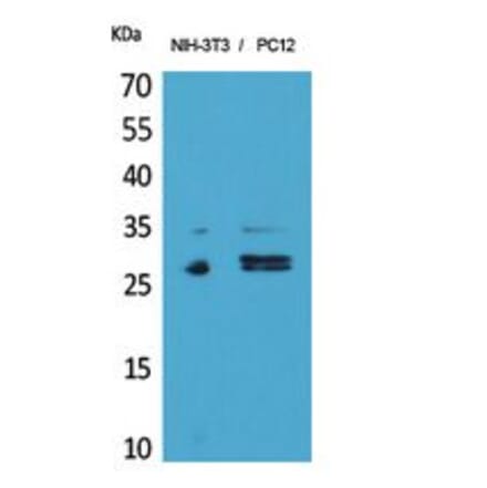 Western blot - DcR1 Polyclonal Antibody from Signalway Antibody (41854) - Antibodies.com