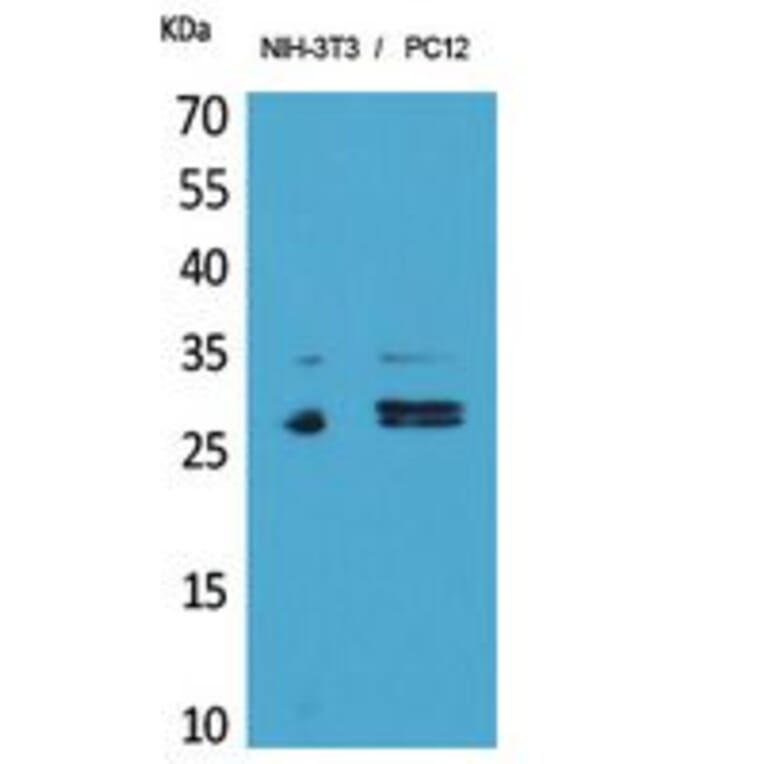 Western blot - DcR1 Polyclonal Antibody from Signalway Antibody (41854) - Antibodies.com