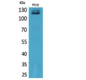 Western blot - UBA1 Polyclonal Antibody from Signalway Antibody (41864) - Antibodies.com