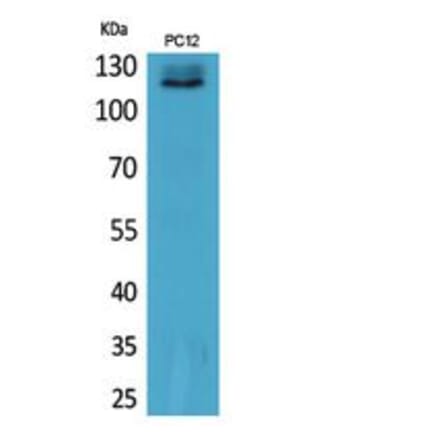 Western blot - UBA1 Polyclonal Antibody from Signalway Antibody (41864) - Antibodies.com