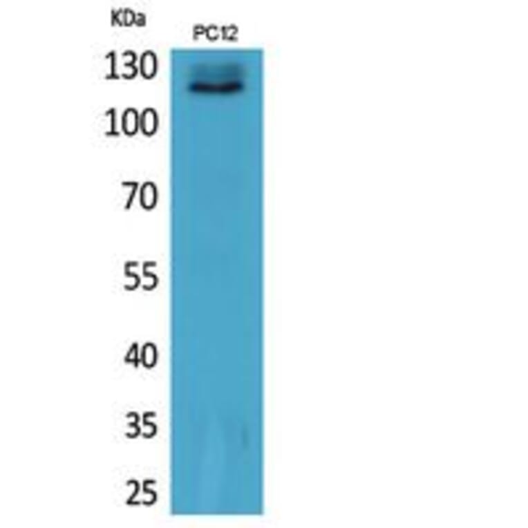 Western blot - UBA1 Polyclonal Antibody from Signalway Antibody (41864) - Antibodies.com