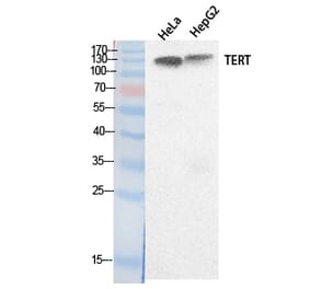 Western blot - TERT Polyclonal Antibody from Signalway Antibody (41884) - Antibodies.com