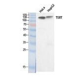 Western blot - TERT Polyclonal Antibody from Signalway Antibody (41884) - Antibodies.com