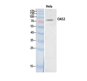 Western blot - OAS2 Polyclonal Antibody from Signalway Antibody (41903) - Antibodies.com