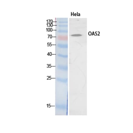 Western blot - OAS2 Polyclonal Antibody from Signalway Antibody (41903) - Antibodies.com