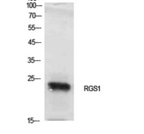 Western blot - RGS1 Polyclonal Antibody from Signalway Antibody (41925) - Antibodies.com