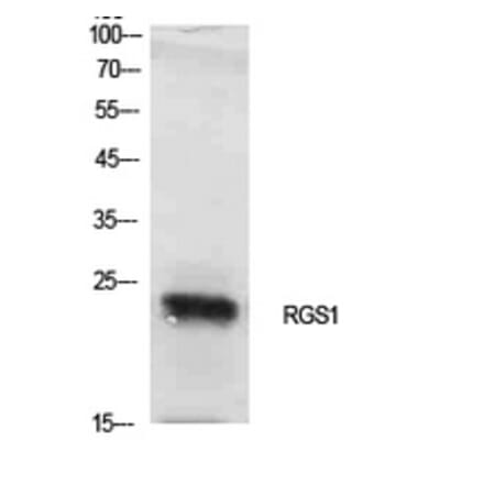 Western blot - RGS1 Polyclonal Antibody from Signalway Antibody (41925) - Antibodies.com