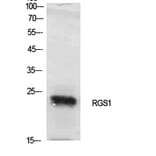 Western blot - RGS1 Polyclonal Antibody from Signalway Antibody (41925) - Antibodies.com