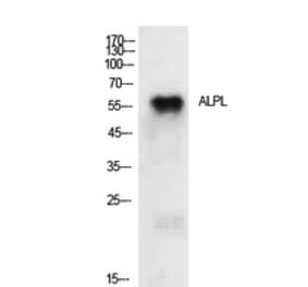 Western blot - TNAP Polyclonal Antibody from Signalway Antibody (41929) - Antibodies.com