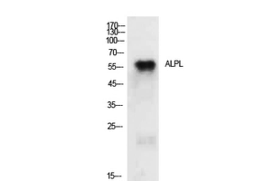 Western blot - TNAP Polyclonal Antibody from Signalway Antibody (41929) - Antibodies.com