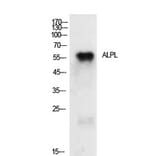 Western blot - TNAP Polyclonal Antibody from Signalway Antibody (41929) - Antibodies.com