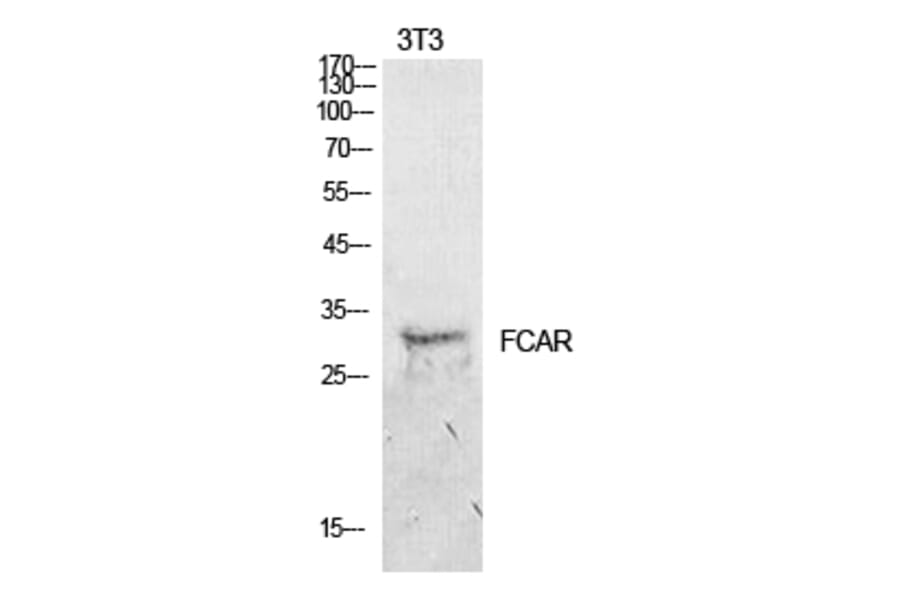 Western blot - CD89 Polyclonal Antibody from Signalway Antibody (41934) - Antibodies.com