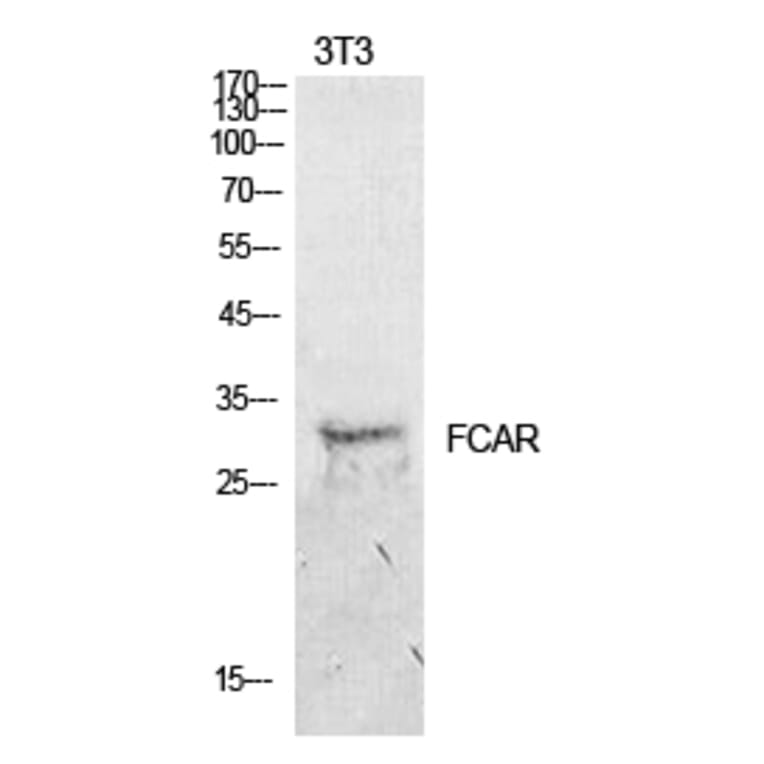 Western blot - CD89 Polyclonal Antibody from Signalway Antibody (41934) - Antibodies.com