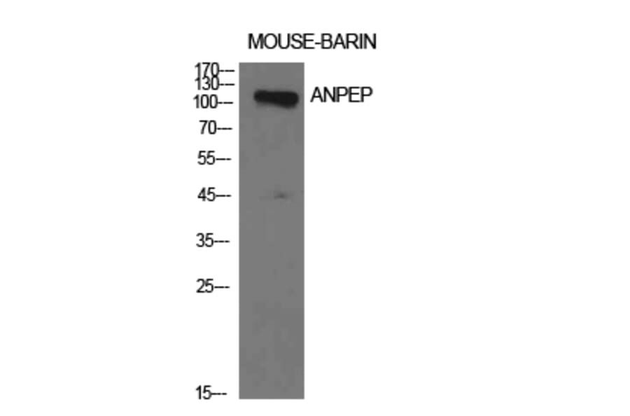 Western blot - CD13 Polyclonal Antibody from Signalway Antibody (41945) - Antibodies.com