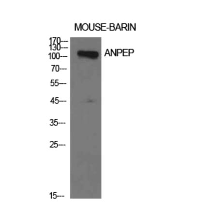 Western blot - CD13 Polyclonal Antibody from Signalway Antibody (41945) - Antibodies.com