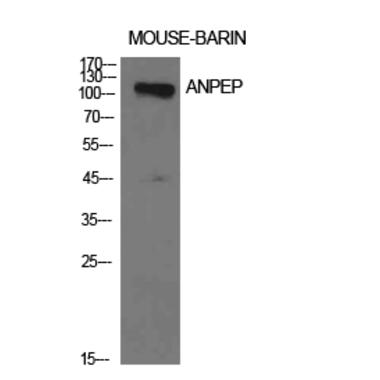 Western blot - CD13 Polyclonal Antibody from Signalway Antibody (41945) - Antibodies.com