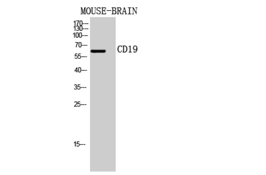 Western blot - CD19 Polyclonal Antibody from Signalway Antibody (41946) - Antibodies.com